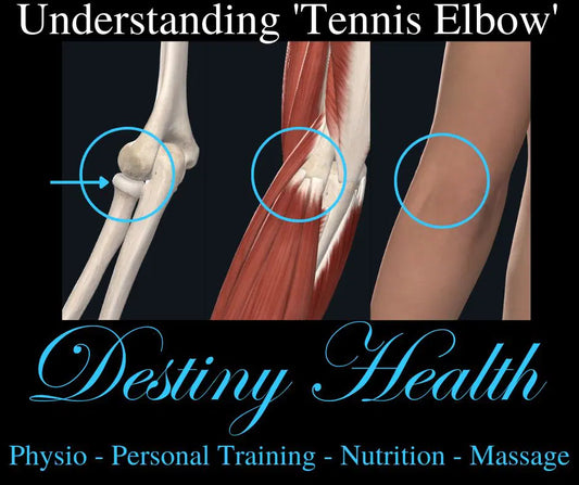 Understaning ‘Tennis Elbow’